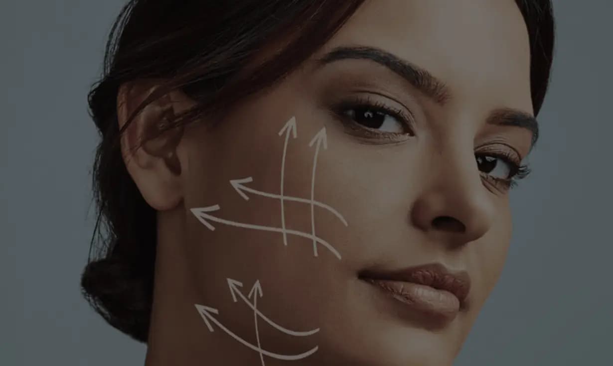 Deep plane facelift hero